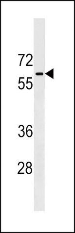 ANTI-PGM5 (C-TERM) antibody produced in rabbit