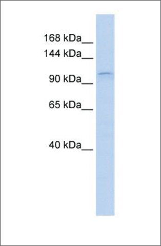 Anti-PGR antibody produced in rabbit