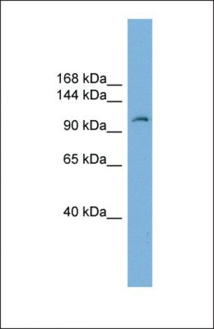 Anti-PGR antibody produced in rabbit