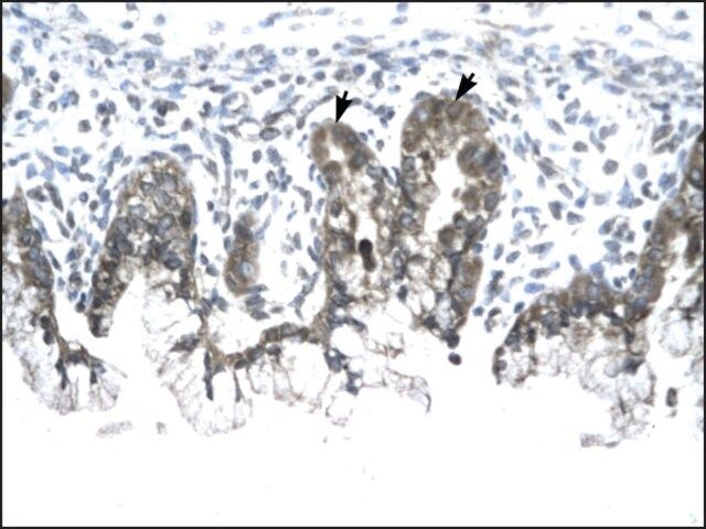 Anti-PHB antibody produced in rabbit