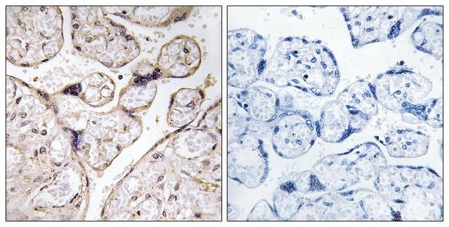 Anti-PHCA antibody produced in rabbit