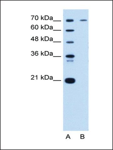 Anti-PGR antibody produced in rabbit