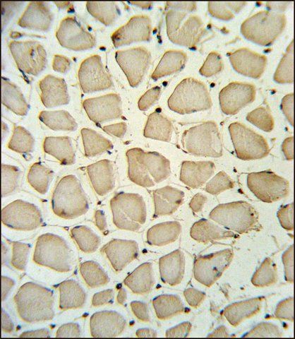 ANTI-PGP (N-TERM) antibody produced in rabbit