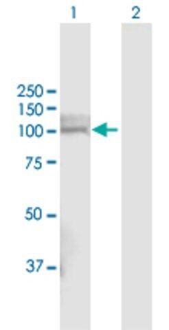 Anti-PHEX antibody produced in rabbit