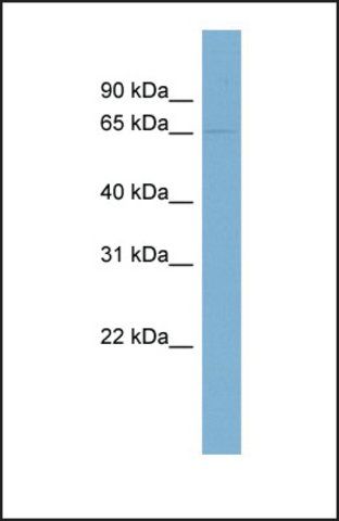 Anti-PHF17, (N-terminal) antibody produced in rabbit