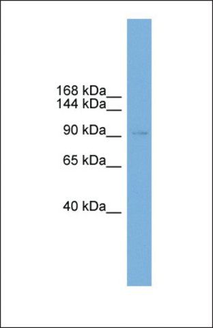 Anti-PHC2, (N-terminal) antibody produced in rabbit