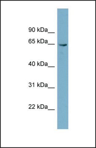 Anti-PGM3, (N-terminal) antibody produced in rabbit