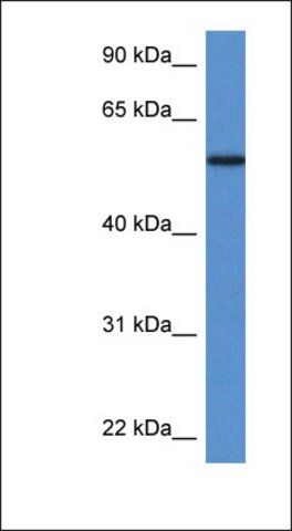 Anti-PGM5 antibody produced in rabbit