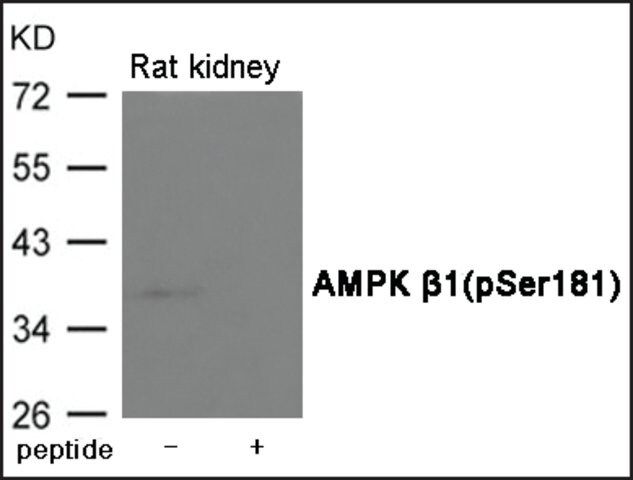 Anti-phospho-AMPK 1 (pSer<sup>181</sup>) antibody produced in rabbit