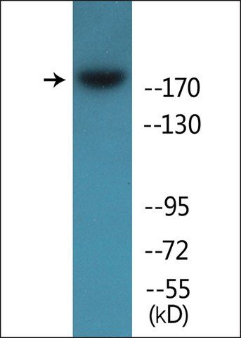 Anti-phospho-ALK (pTyr<sup>1507</sup>) antibody produced in rabbit