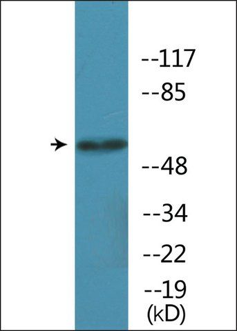 Anti-phospho-Akt (pSer<sup>246</sup>) antibody produced in rabbit