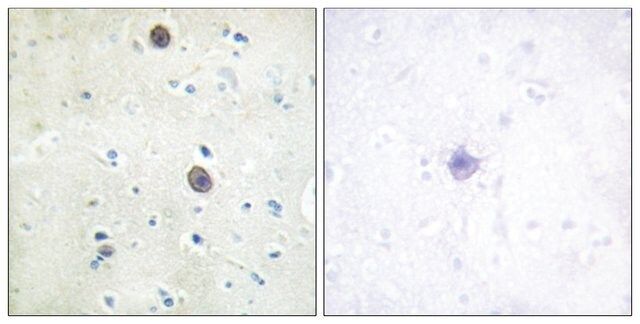 Anti-phospho-Amyloid  A4 (pThr<sup>743/668</sup>) antibody produced in rabbit