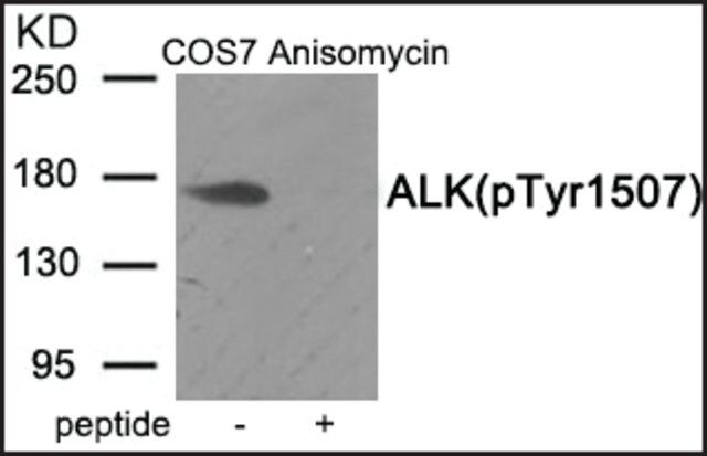 Anti-phospho-ALK (pTyr<sup>1507</sup>) antibody produced in rabbit