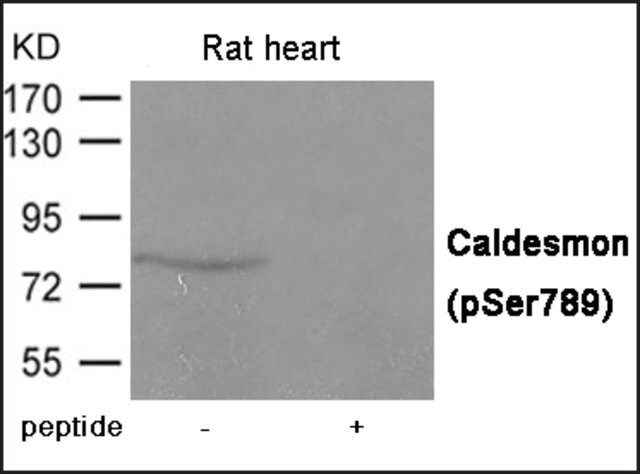 Anti-phospho-Caldesmon (pSer<sup>789</sup>) antibody produced in rabbit