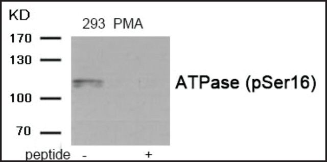 Anti-phospho-ATPase (pSer<sup>16</sup>) antibody produced in rabbit