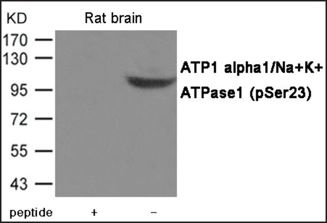 Anti-phospho-ATP1 1/Na+K+ (pSer<sup>23</sup>) antibody produced in rabbit