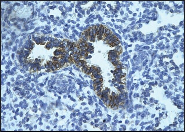 Anti-PHF16 antibody produced in rabbit