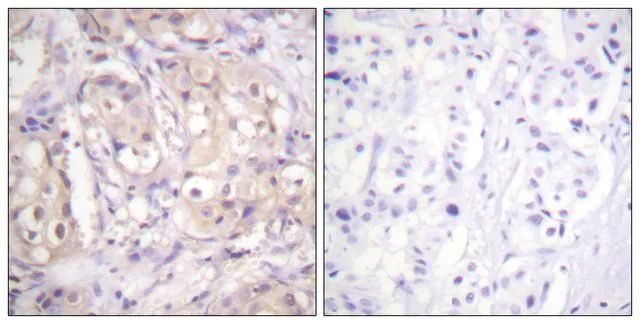 Anti-phospho-B-RAF (pThr<sup>599</sup>) antibody produced in rabbit