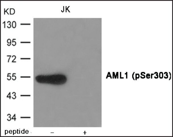 Anti-phospho-AML1 (pSer<sup>303</sup>) antibody produced in rabbit