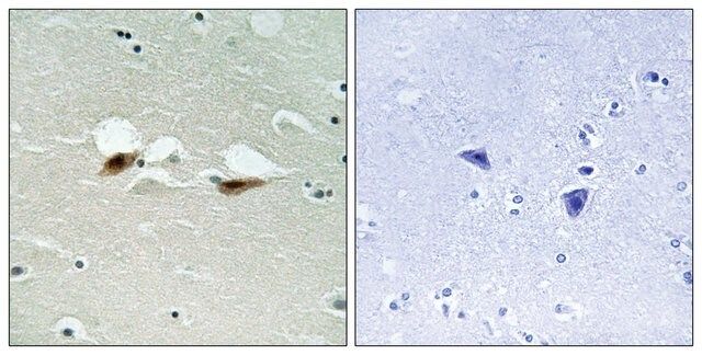 Anti-phospho-ATF-2 (pSer<sup>472</sup>) antibody produced in rabbit