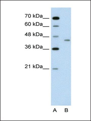 Anti-LRP2BP antibody produced in rabbit