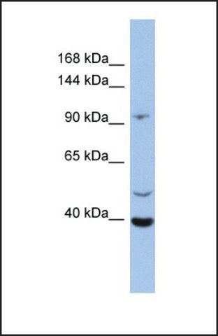 Anti-LRRC37B, (N-terminal) antibody produced in rabbit