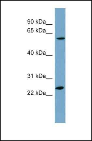 Anti-LRRC6, (N-terminal) antibody produced in rabbit