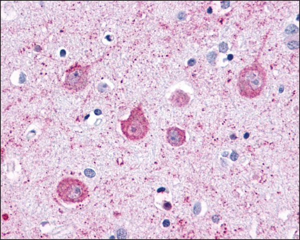 Anti-LPHN2 antibody produced in rabbit