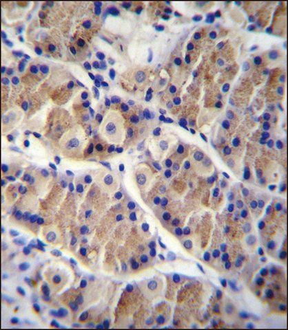 ANTI-LRRC38 (C-TERM) antibody produced in rabbit