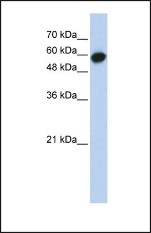 Anti-LRRC6 antibody produced in rabbit