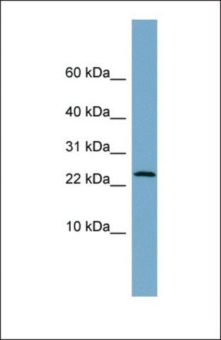 Anti-LRRC20 antibody produced in rabbit