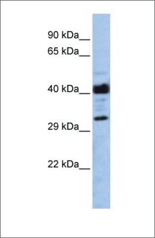 Anti-LRRC57 antibody produced in rabbit