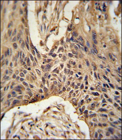 ANTI-LPPR4 (C-TERM) antibody produced in rabbit