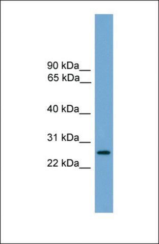 Anti-LRRC3 antibody produced in rabbit