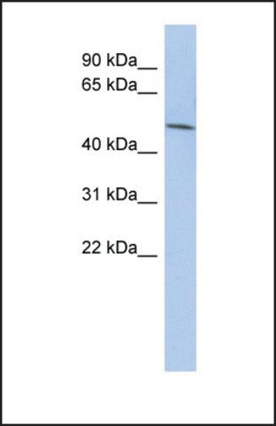 Anti-LRRC42, (N-terminal) antibody produced in rabbit