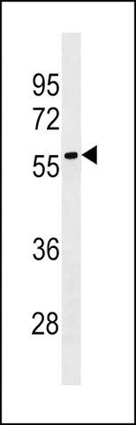 ANTI-LRRC69 (CENTER) antibody produced in rabbit