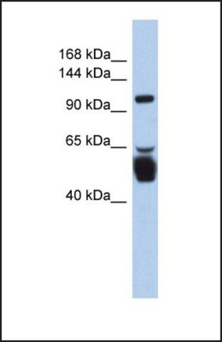 Anti-LRRC8B, (N-terminal) antibody produced in rabbit