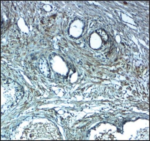 Anti-LRRC26 antibody produced in rabbit