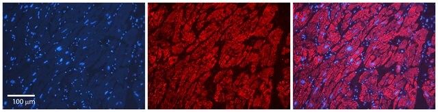 Anti-LSM1 antibody produced in rabbit