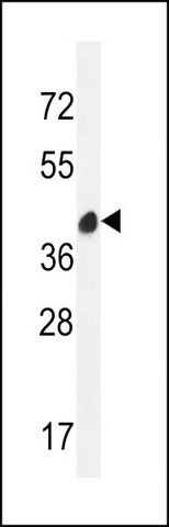 ANTI-LRRC72 (C-TERM) antibody produced in rabbit