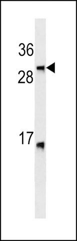 ANTI-LTB(C-TERMINAL) antibody produced in mouse