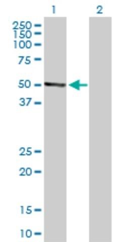 Anti-LUM antibody produced in rabbit