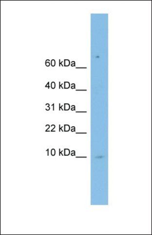 Anti-LSM6 antibody produced in rabbit