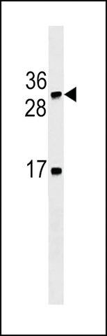 ANTI-LTB(C-TERMINAL) antibody produced in mouse