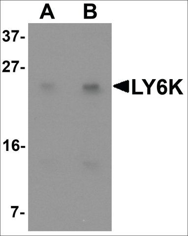 Anti-LY6K antibody produced in rabbit