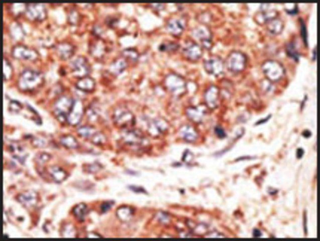 Anti-MAFK (C-term) antibody produced in rabbit