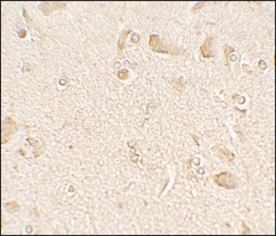 Anti-MAP1LC3C antibody produced in rabbit