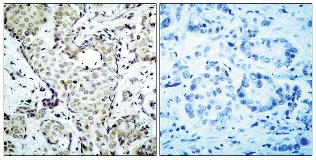 Anti-MAP2K6 (Ab-207) antibody produced in rabbit