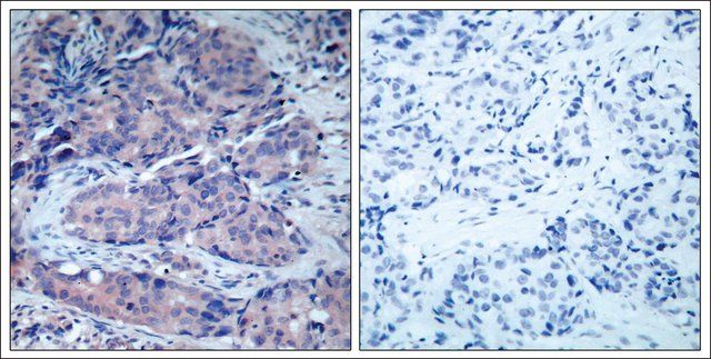 Anti-MAP2K4 (Ab-261) antibody produced in rabbit