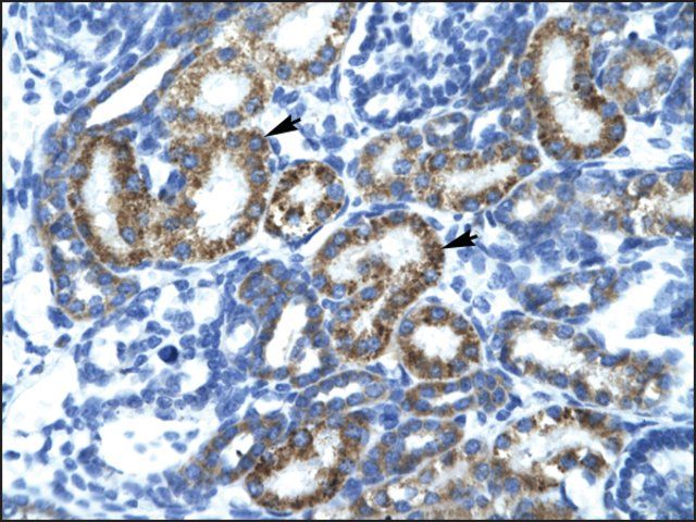 Anti-FLJ14768 antibody produced in rabbit